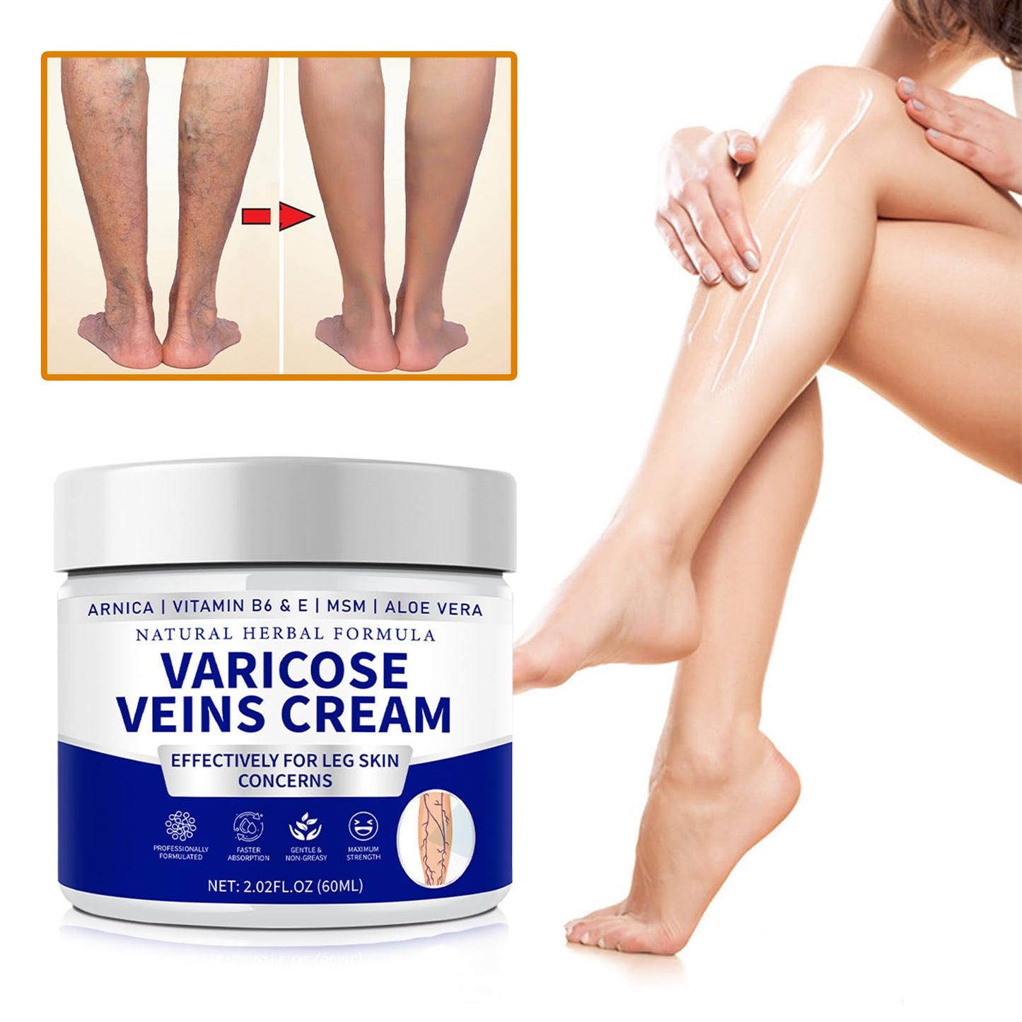 Vivipop 2026 Varicose Veins Legs Cream - Varicose Veins Cream, Spider Vein Cream with Natural Herbal Formula for Women and Men Leg Skin Care