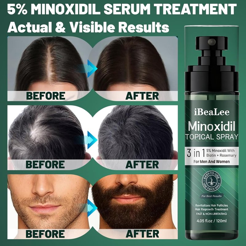 Minoxidil Hair Growth Treatment for Men & Women - Biotin & Rosemary Beard Growth Serum | Strengthens Roots, Repairs Thinning Hair