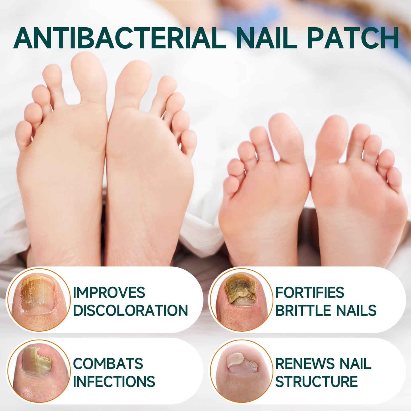 32 Pcs Fungal Nail Patches, Toenail Fungus Treatment Extra Strong Formula, Nail Repair for Damaged Nails, Overnight Renewal for Men and Women