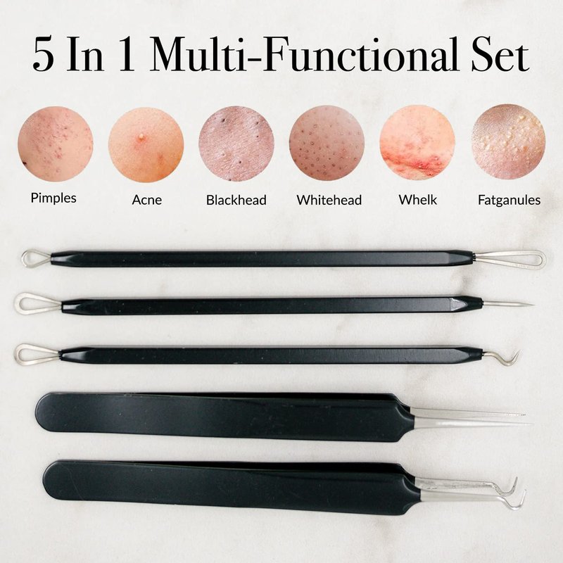 Pete & Pedro Acne & Blackhead Remover Skin Care Tool Set for Men & Women - 5 Piece Pimple Popper Kit + Mirror! | Removal of Whiteheads, Zits, Black Heads, Comedone Extractor | As Seen on Shark Tank