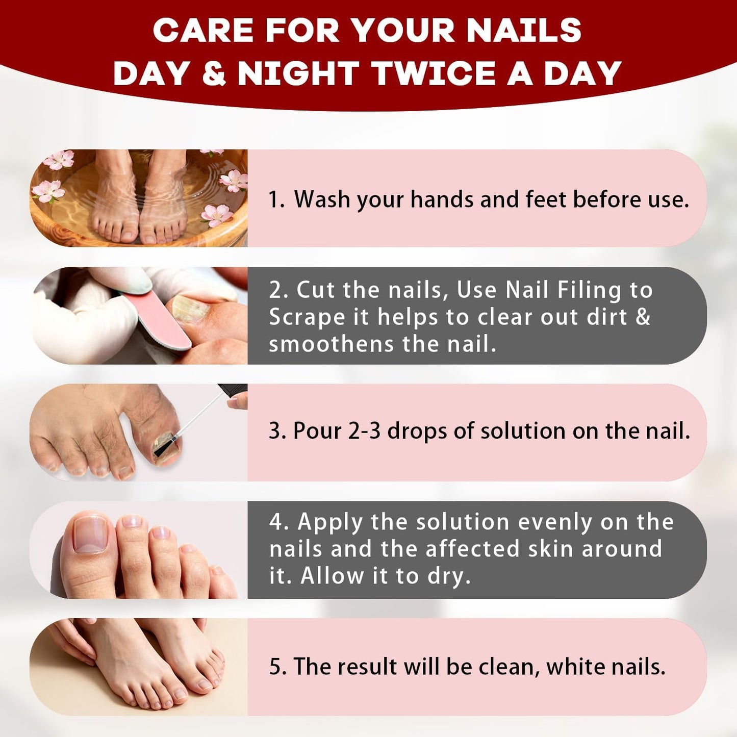 SOVS Toenail Treatment,Gentle Formula, Effectively Improves Nails for a More Beautiful Appearance（1pcs）