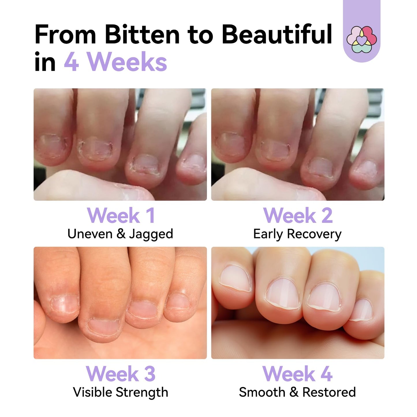 SAVILAND Nail Biting Prevention for Adults 0.51oz: Extreme Bitter Nail Biting Treatment 72H Lasting Nail Biting Treatment 2-in-1 Natural Stop Biting Nail Strength Repair Nail With Marigold &Aloe Vera
