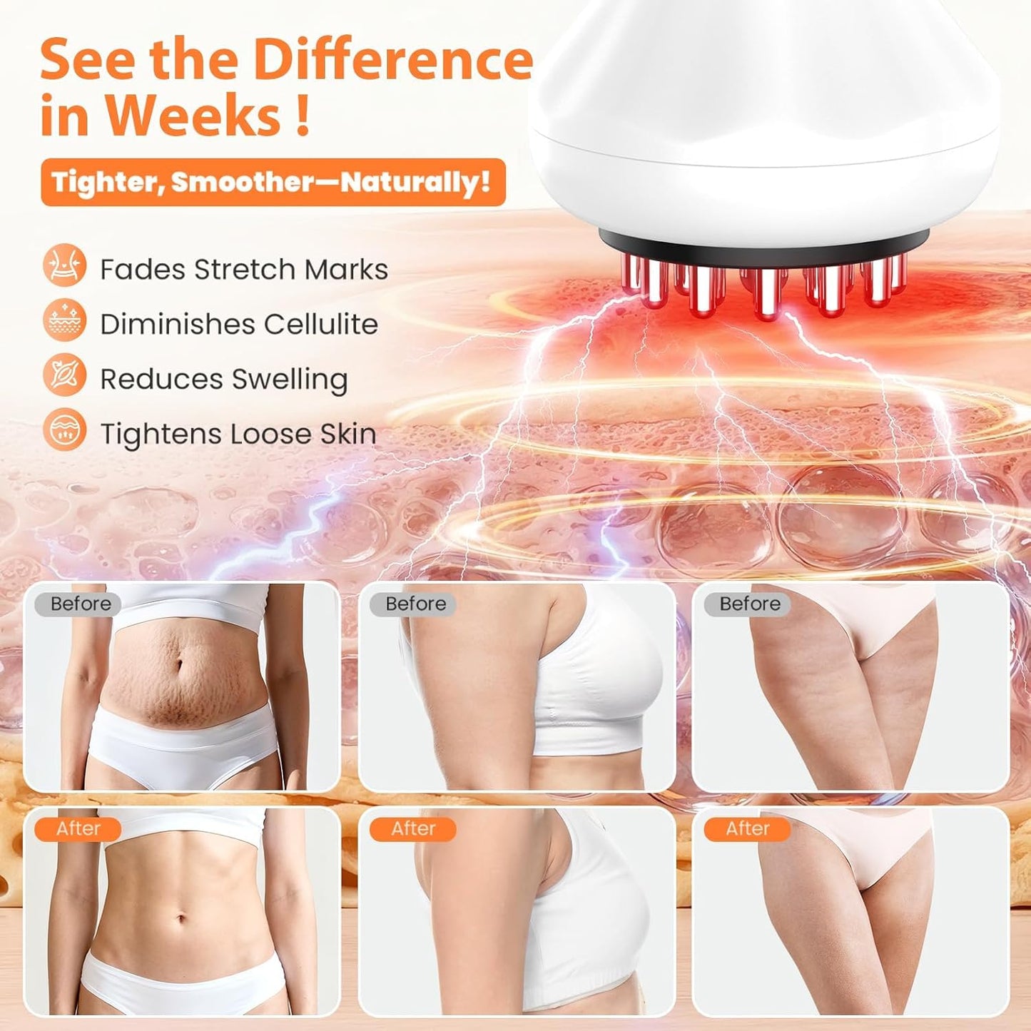ZOVLO Lymphatic Drainage Massager, Anti Cellulite Massage Tool & Body Sculpting Machine, 4-in-1 Microcurrent, Red Light, Heat & Vibration, 21 Heads for Legs Arms & Belly, Helps Reduce Stretch Marks