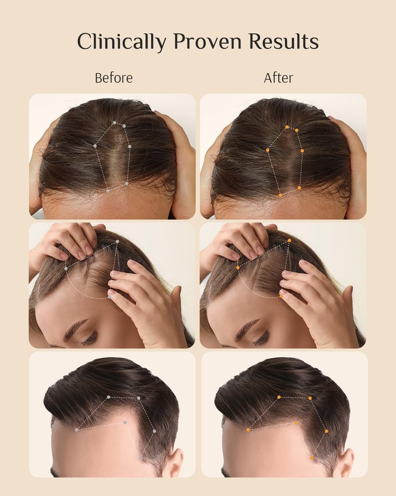 Hair Growth Serum for Women - 3% Redensyl Japanese Treatment for Thinning Hair | Scalp Care, 60ml