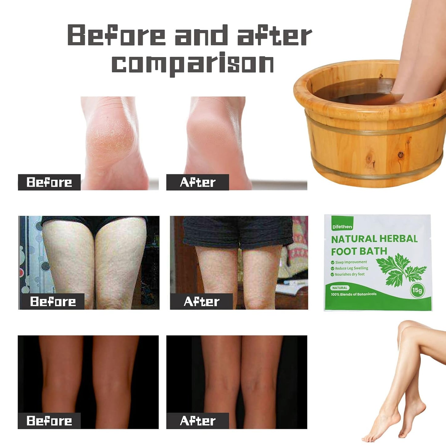 Mugwort Herbal Foot Soak - Lymphatic Ginger Bath Bag for Anti-Swelling | 15g x 10 Packs