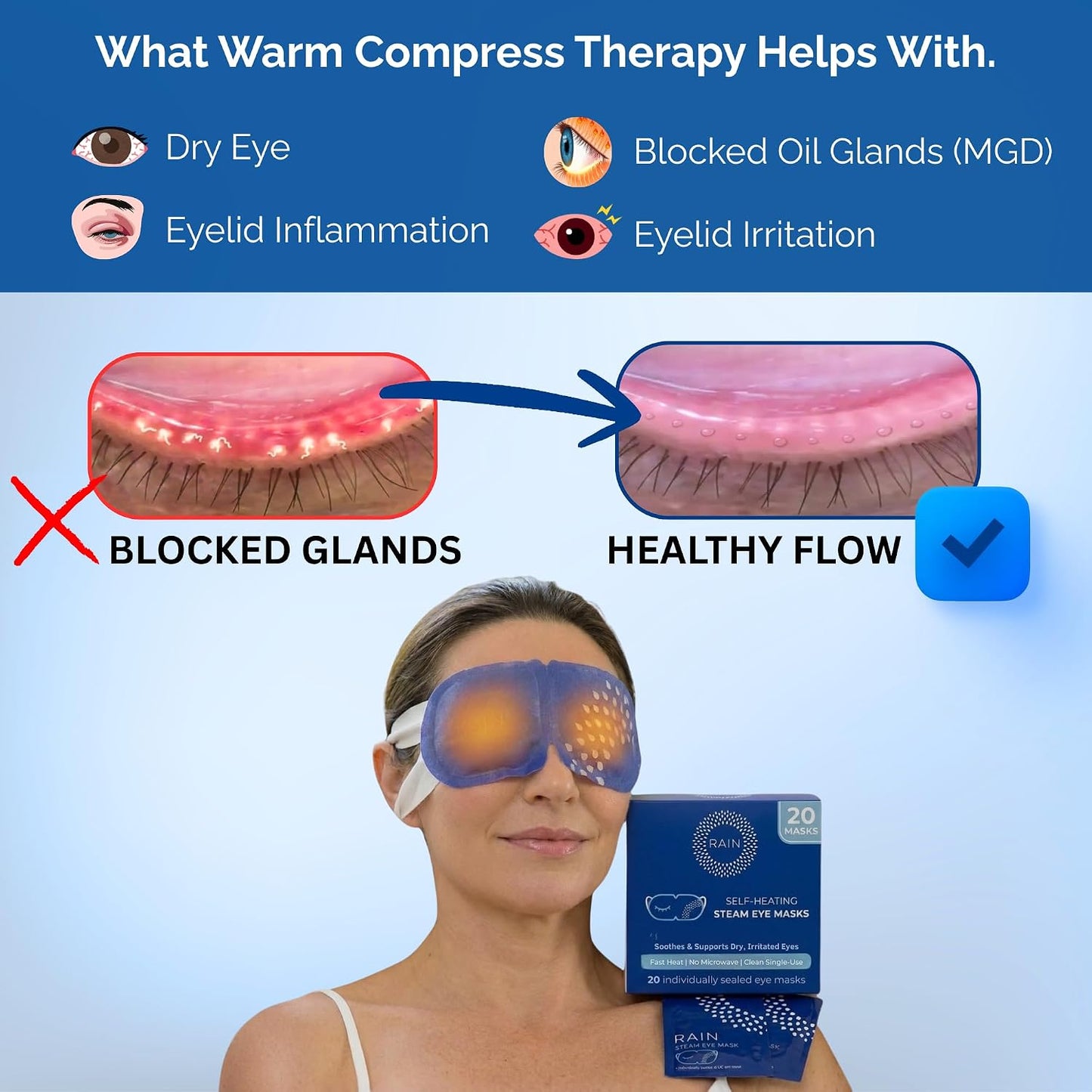 Heated Eye Mask for Dry Eyes - Self-Heating Steam Compress | 20 Disposable Masks, Unscented, Travel Ready