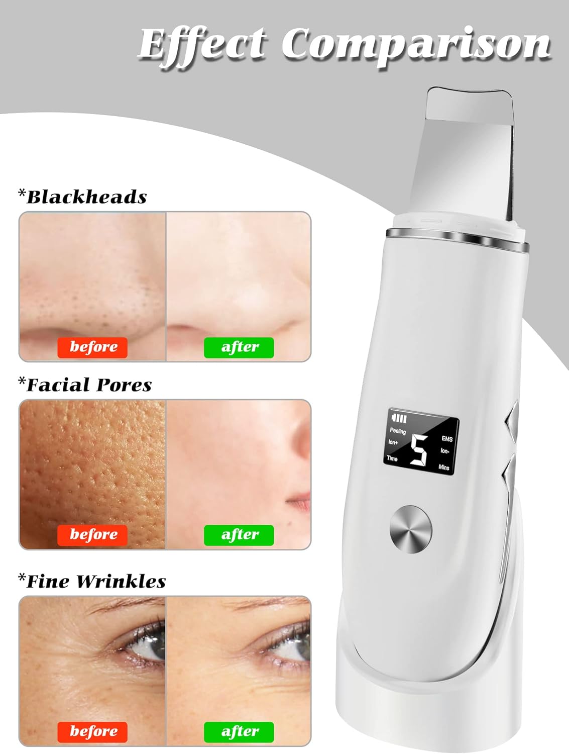 Skin Scrubber Face Spatula - 4-in-1 Blackhead Remover Tool for Deep Pore Cleansing | USB Rechargeable