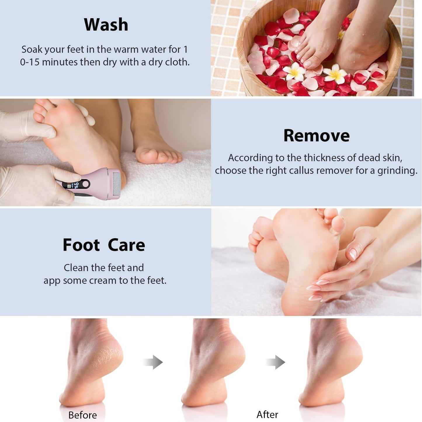 AdamPark Electric Callus Remover for Feet, Rechargeable Portable Electronic Foot Callus Remover 2-in-1 Wet/Dry Foot Scrubber Electric Toot File for Hard Cracked Dry Dead Skin（Pink）