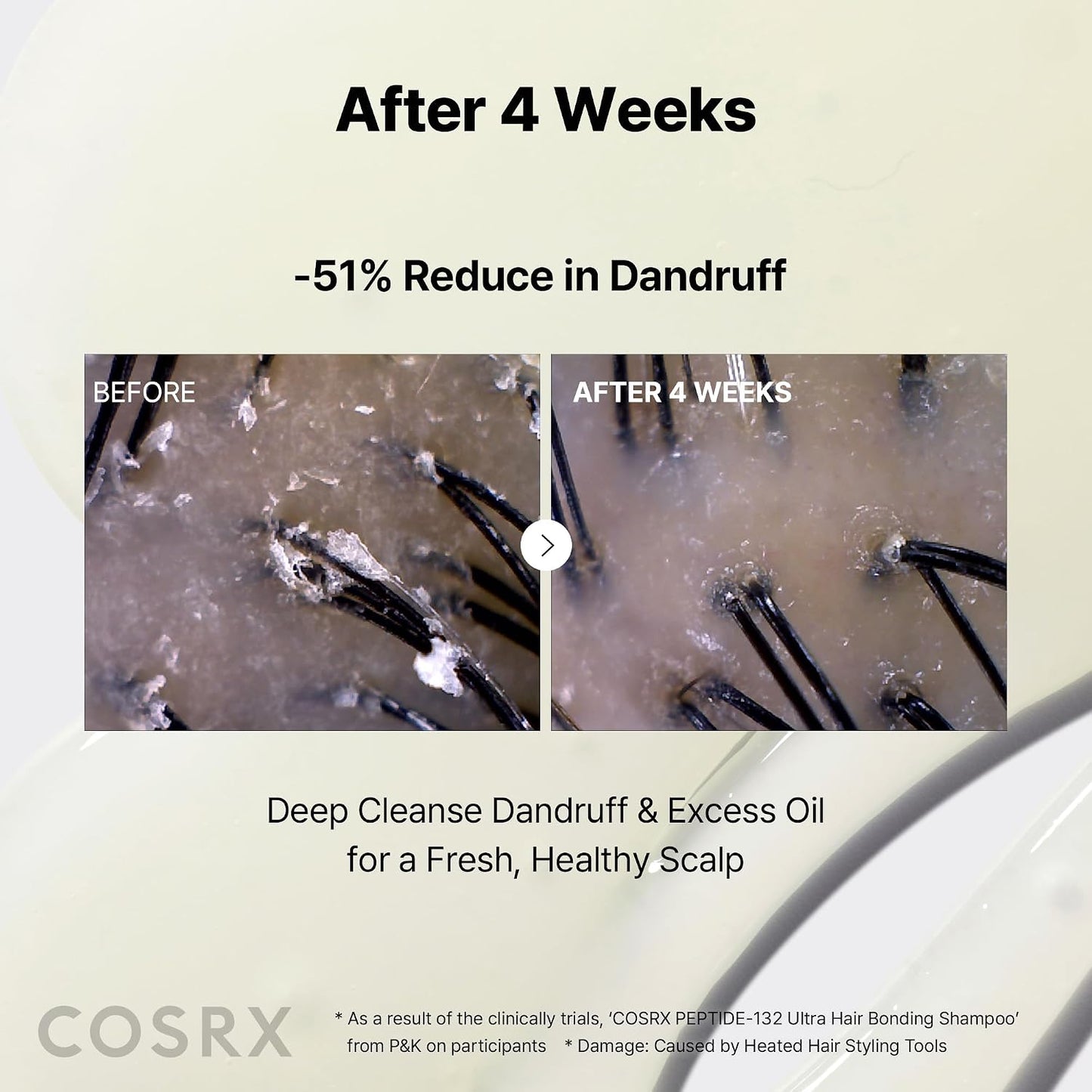 COSRX Peptide 132 Hair Bonding Shampoo - Daily Scalp Treatment for Dandruff & Damaged Hair - 6.76 fl oz