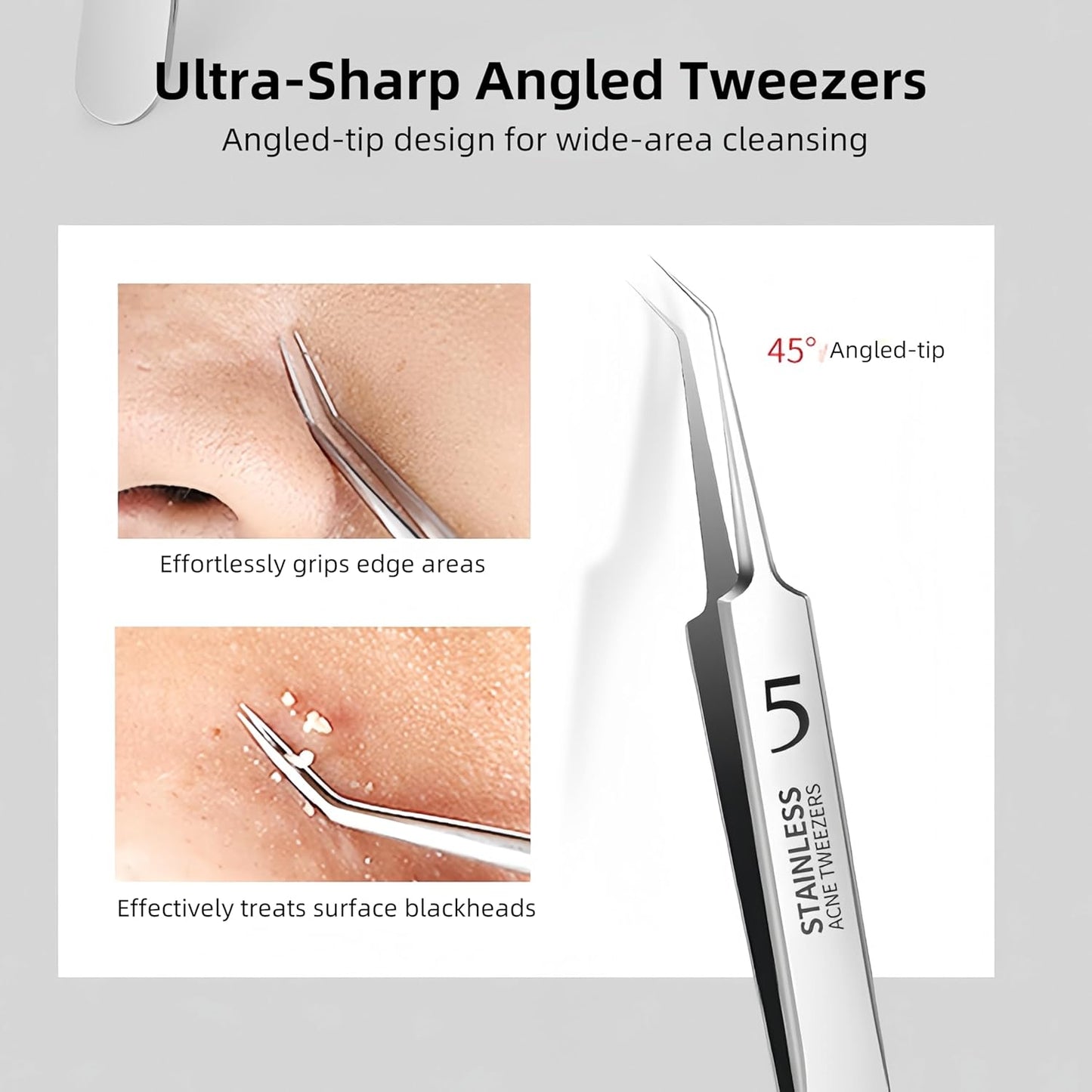 Blackhead Tweezers Set - Precision Stainless Steel Acne Removal Kit | 3-Piece Tool for Pimples & Ingrown Hairs