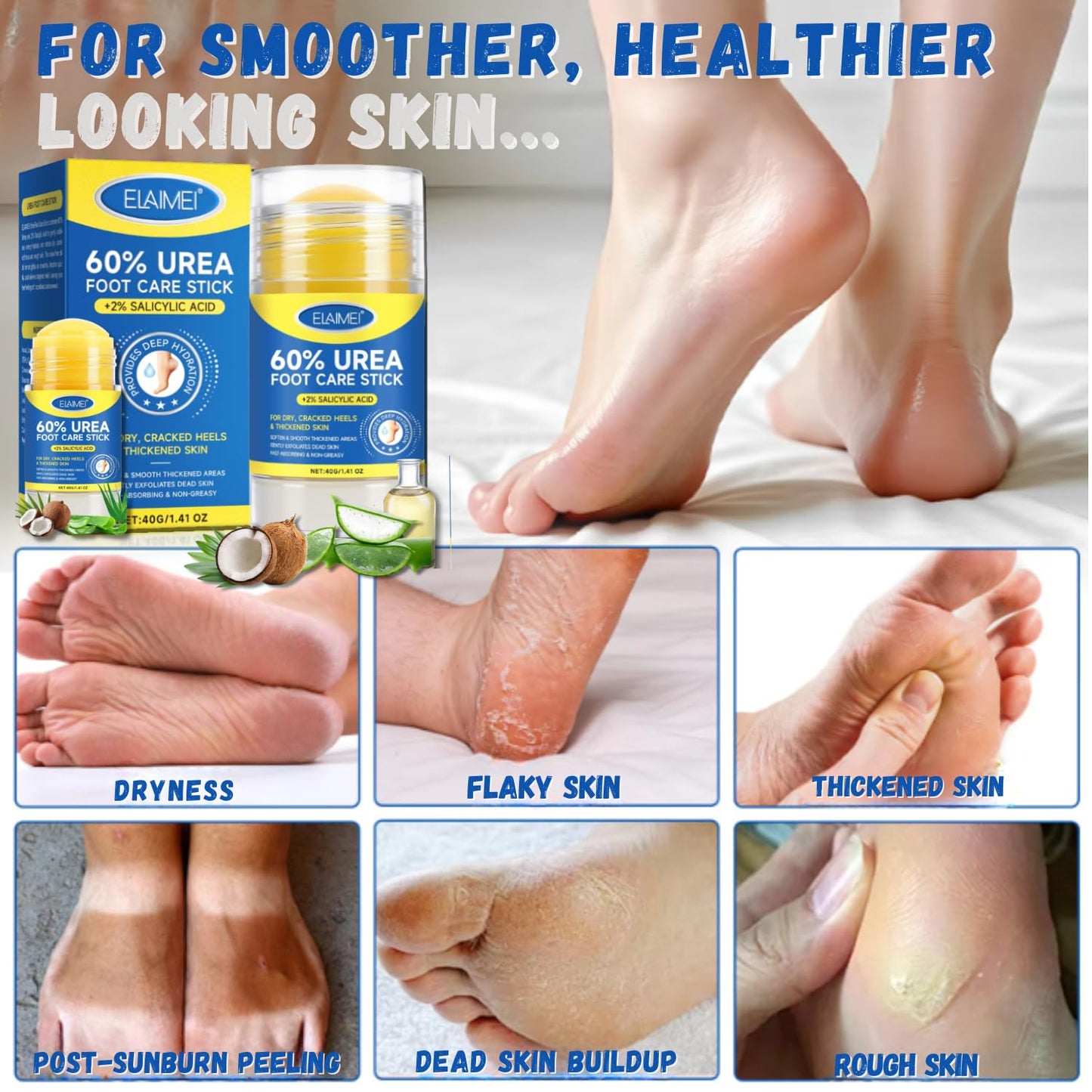 60% Urea Cream Stick with 2% Salicylic Acid, Maximum Strength Urea Foot Cream for Dry Cracked Heels & Feet, Callus Remover, Heel Balm, Fast Absorbing Moisturizer for Rough Hands, Knees & Elbows 1.41oz