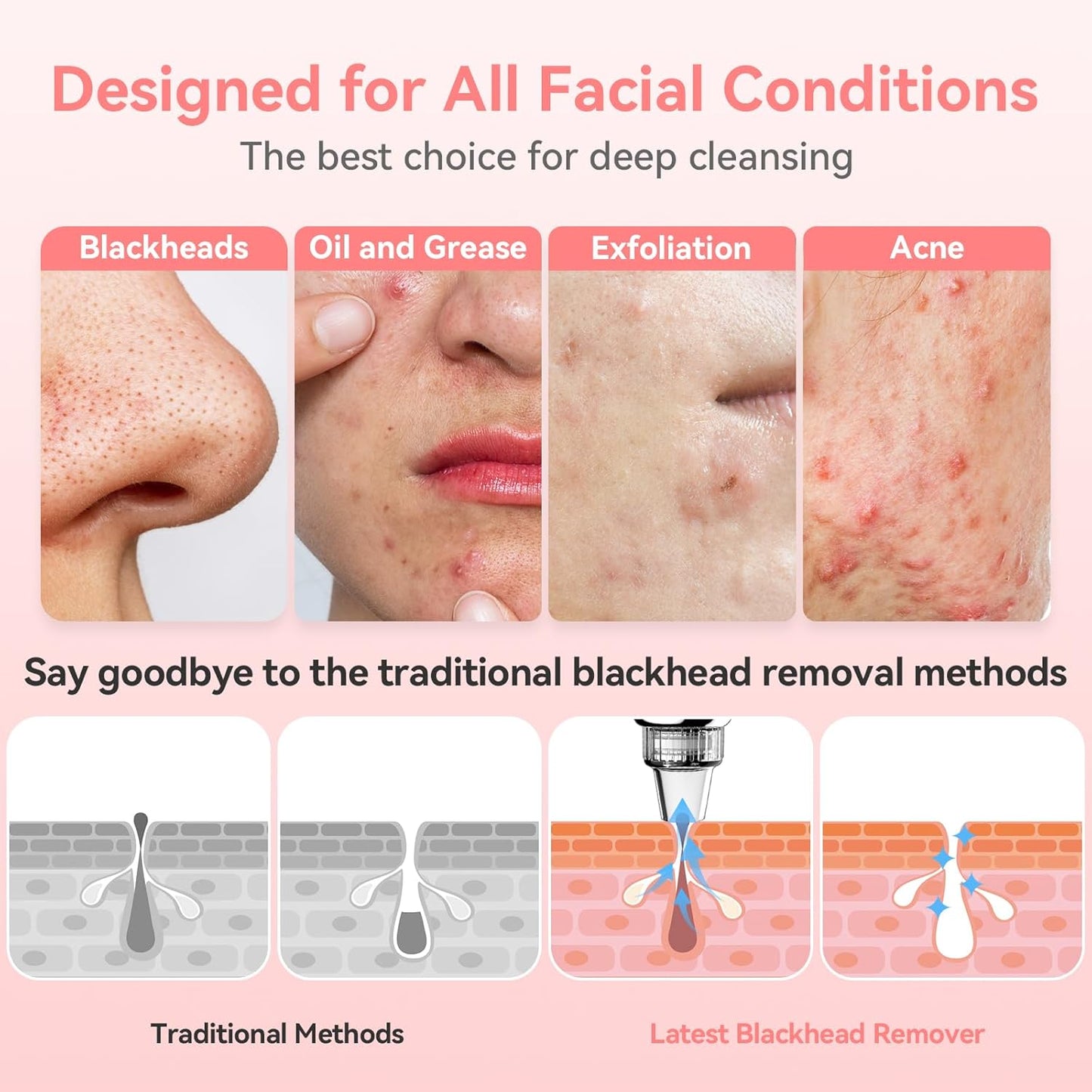 Blackhead Remover Vacuum | Upgraded Electric Pore Cleaner Tool - 5 Suction Levels, USB Rechargeable, 5 Probes for All Skin Types