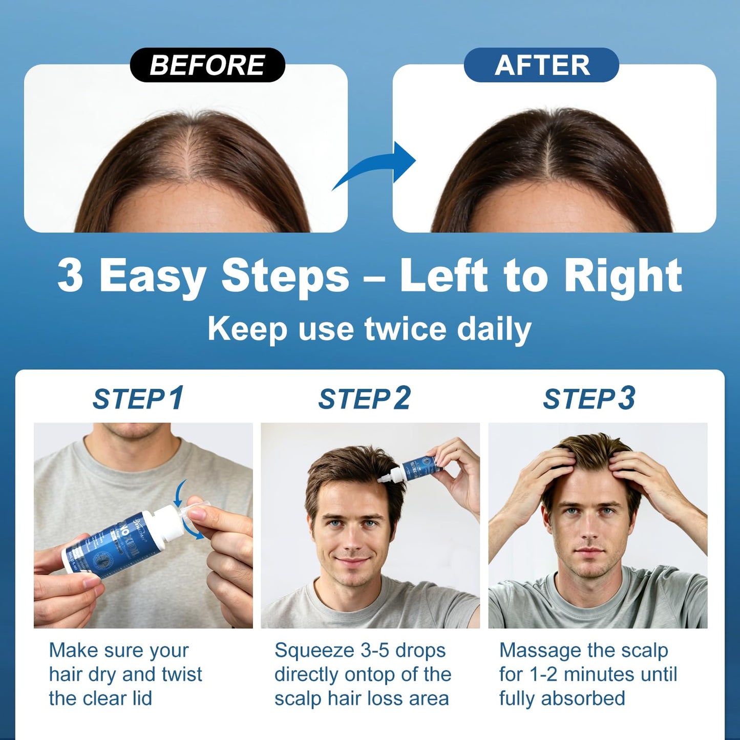 8 Pack 5% Minoxidil Hair & Beard Growth Serum, with Biotin & Castor Oil, Minoxidil for Men & Women, Supports Thicker, Fuller Hair, Reduces Thinning & Hair Loss, 8-Month Supply
