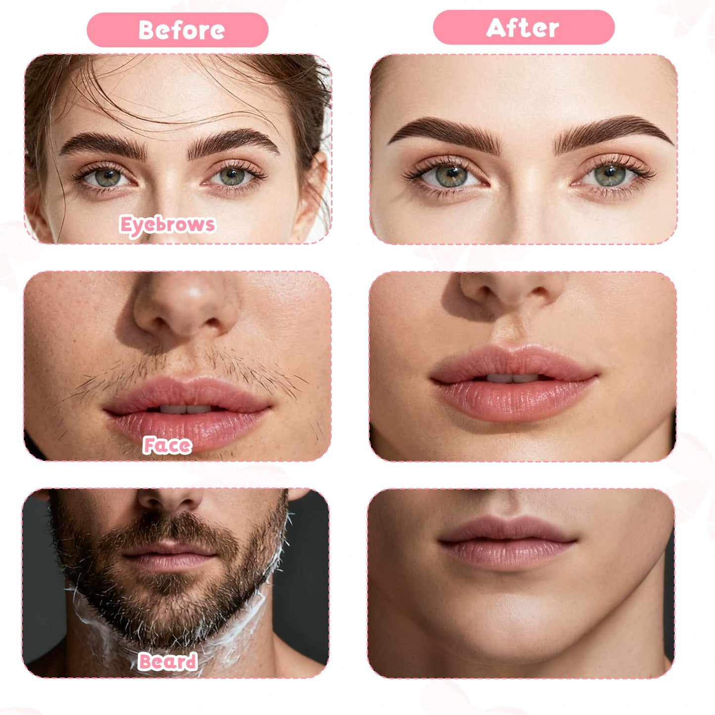6Pack Eyebrow Razors Stainless Steel Dermaplaning Tool for Face, Small Eyebrow Shaver for Women Men Peach Fuzz and Fine