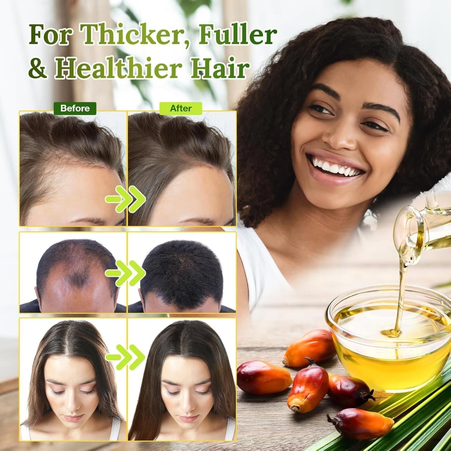 Batana Oil for Hair Growth - Organic Unrefined Hair Oil | Restores Damaged Hair & Scalp, 4.2 OZ