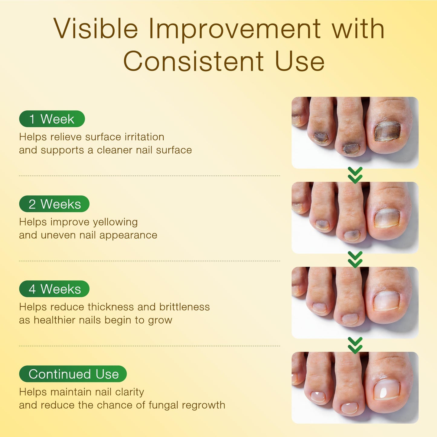 Toenail Fungus Treatment with 25% Undecylenic Acid & Tolnaftate, SafeFight Nail Repair Solution for Fungi Nail, Toenail Fungus Treatment Extra Strength Nail Repair for Fungi Nail