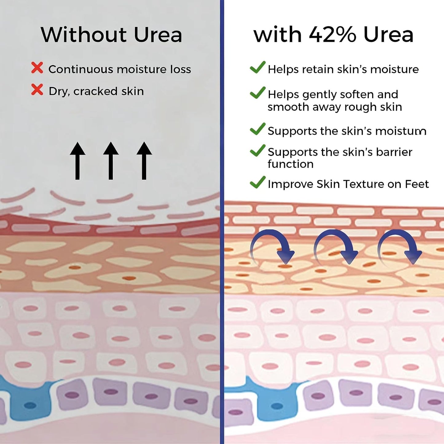 Urea Cream 42% with 2% Salicylic Acid - Moisturizing Foot Cream for Dry, Rough Skin | 5.29 Oz