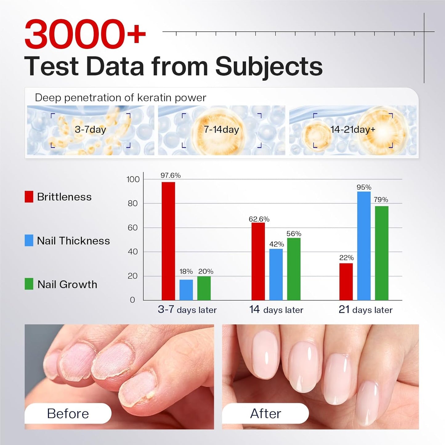 Morovan Nail Strengthener - Keratin Ridge Filler for Thin, Weak Nails | Milky White 15ml