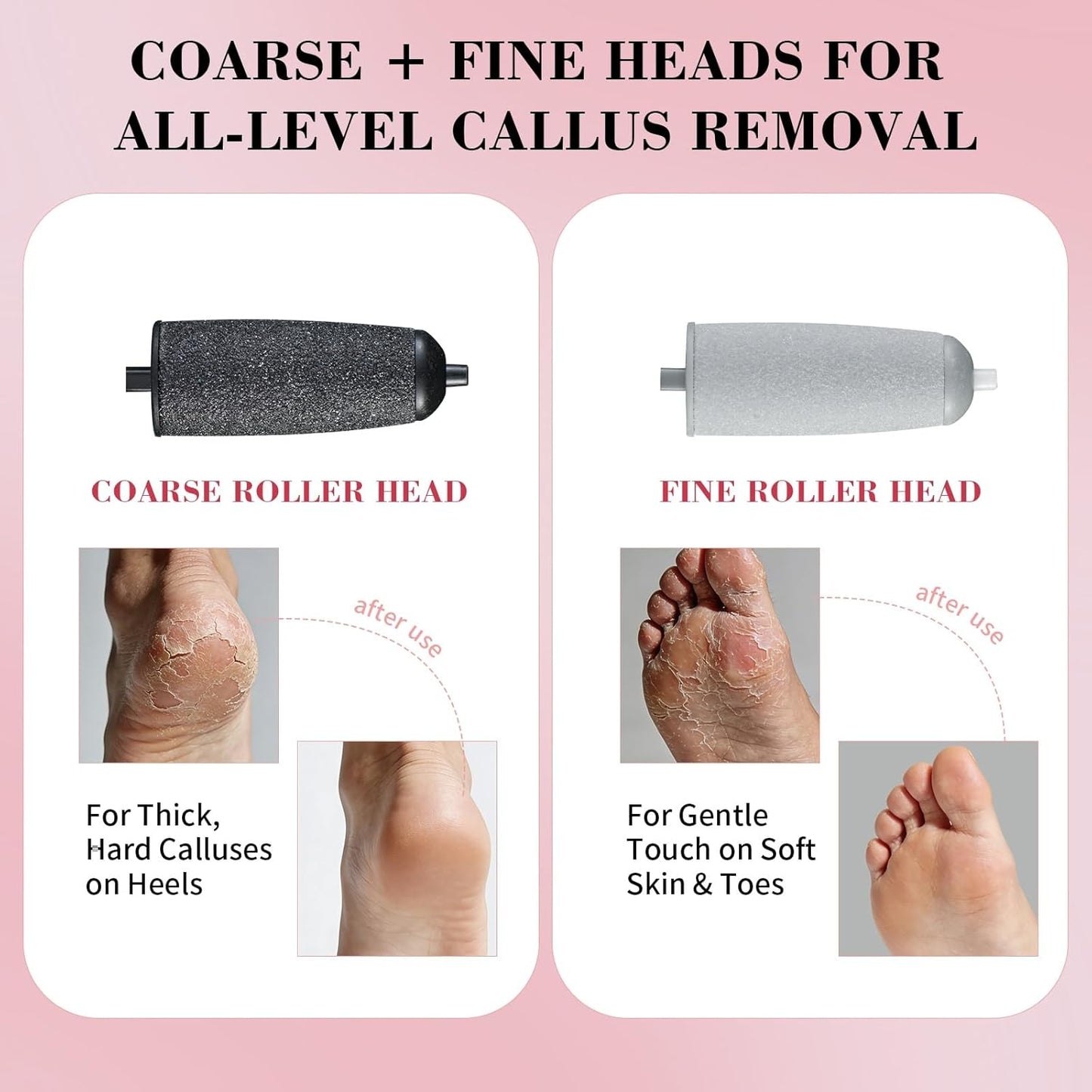 Electric Foot Callus Remover - Dual Roller Heads, 2 Speeds & LED Light | 90-Min Runtime Pedicure Tool