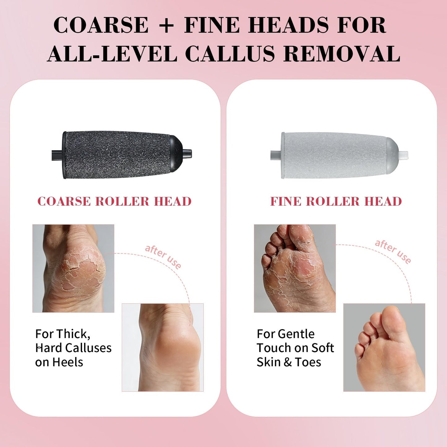 PALETTECH Foot Callus Remover, Electric Callus Remover for Feet with Dual Roller Heads, 2 Speeds & LED Light, 3× Faster Than Manual, 90-Min Runtime, Pedicure Tools for Feet, Foot File for Home Use