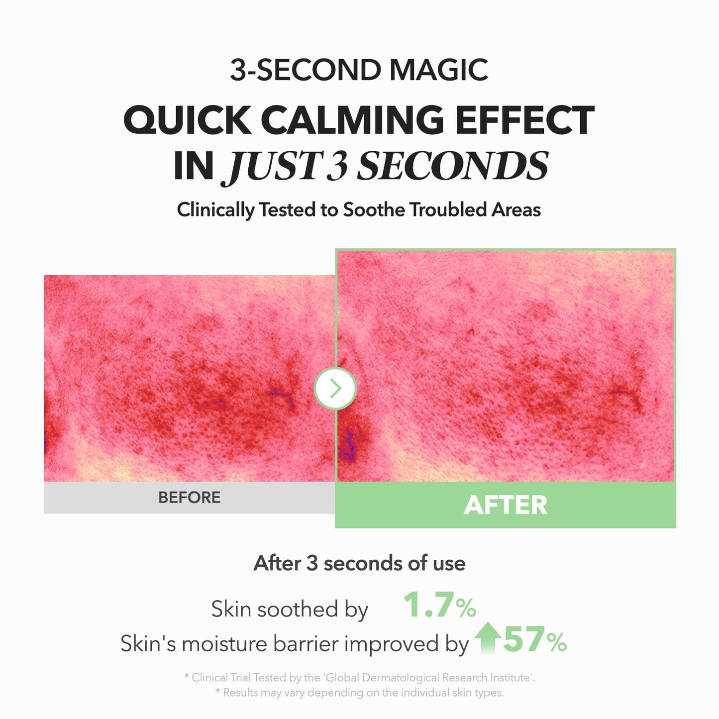 APRILSKIN A.C.E Serum｜Mugwort Centella Serum for Soothing & Calming｜3-Second Calming｜Mugwort Leaf Water 50% + Centella Leaf Water 40% for Troubled Skin｜Korean Skin Care｜3.88 oz