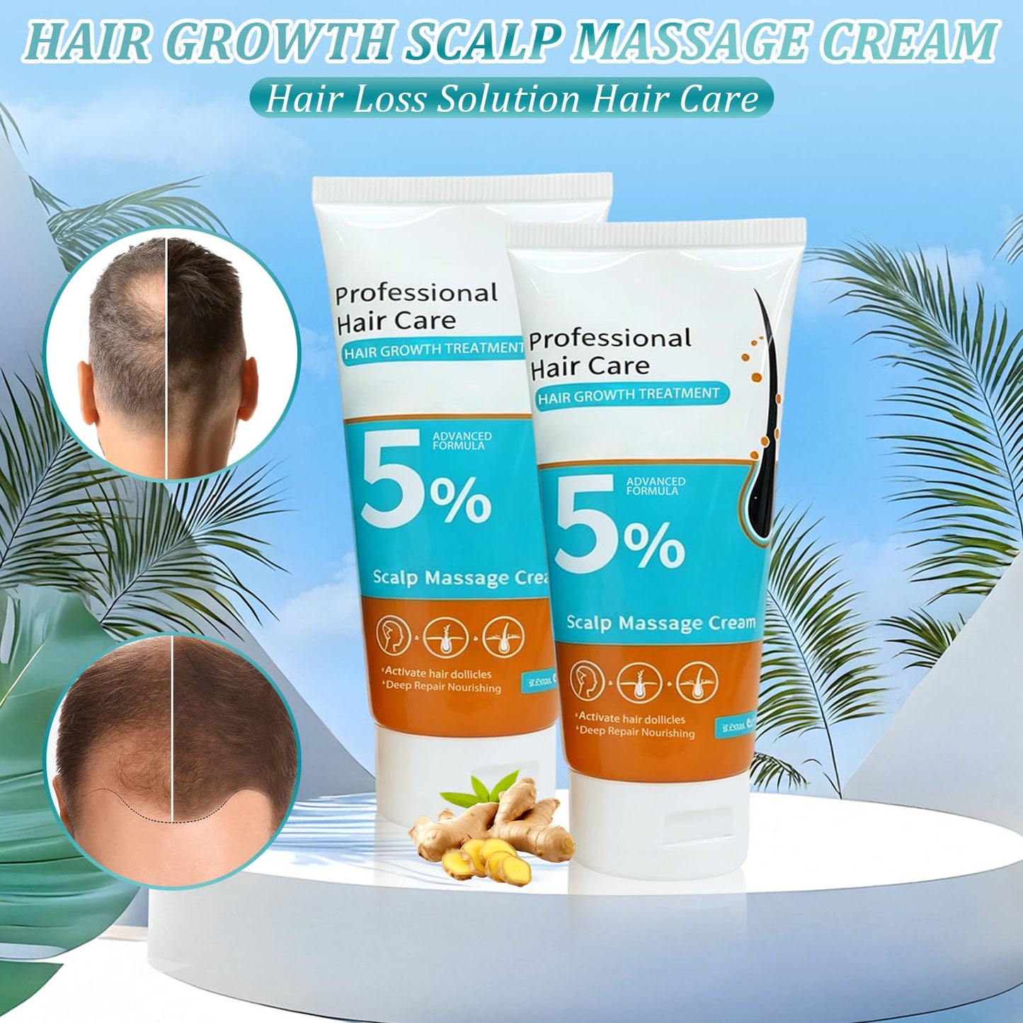 Minoxidil Hair Growth Cream - Anti Hair Loss Treatment for Men & Women | Fast Regrowth & Strengthens Roots (2PCS)
