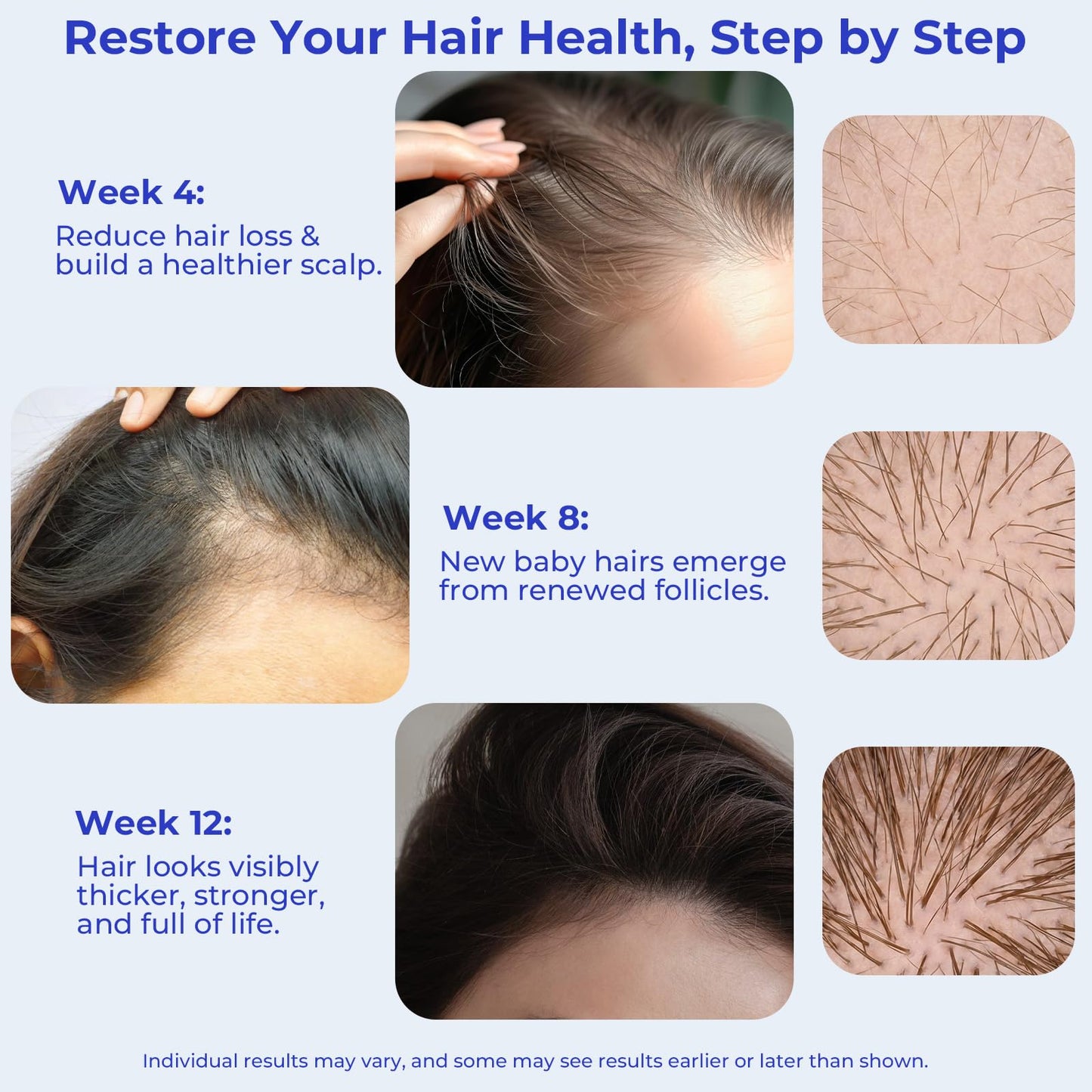 Rosemary Oil Hair Growth Serum Roll On – 3% Rosemary Oil, 2% Caffeine, 2% Niacinamide & DHT Blocking Complex, Non-Greasy Scalp Serum for Men & Women, Designed for Thinning, Fine & Weak Hair, 2-Pack