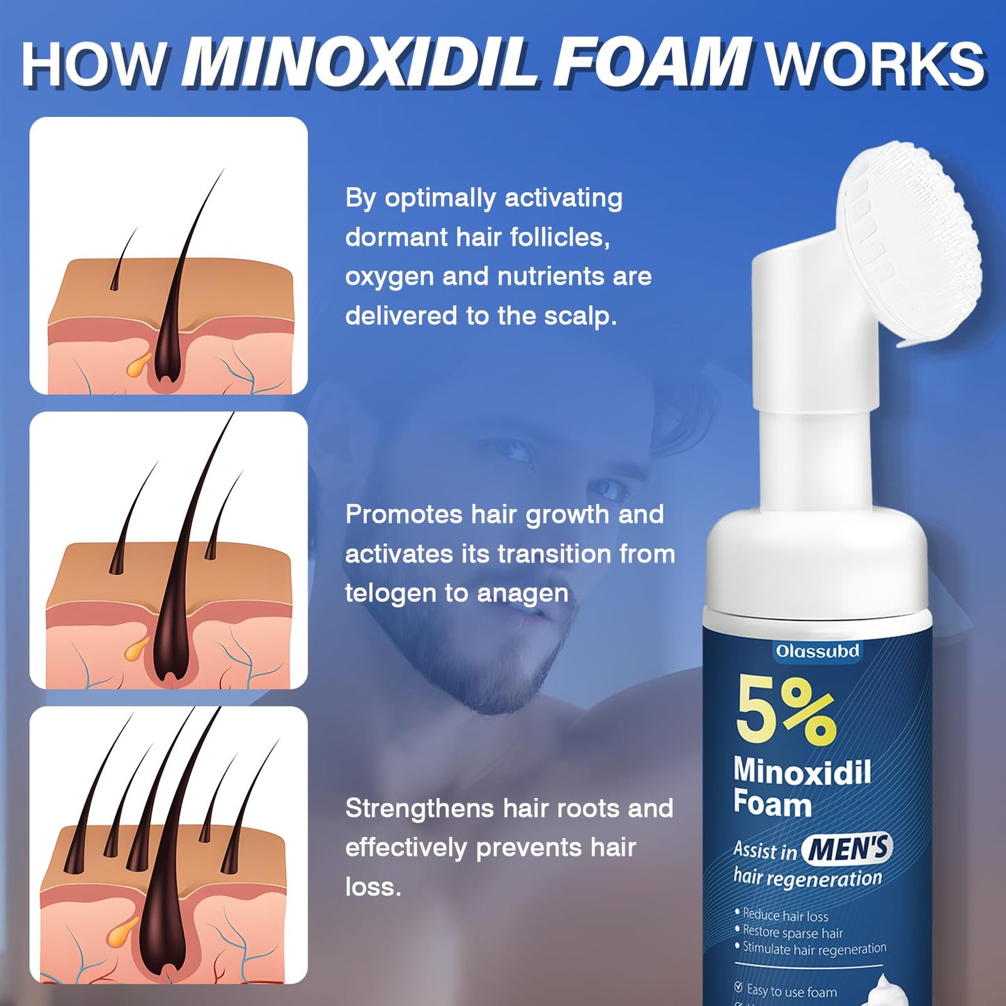 Minoxidil 5% Foam for Men Hair Growth