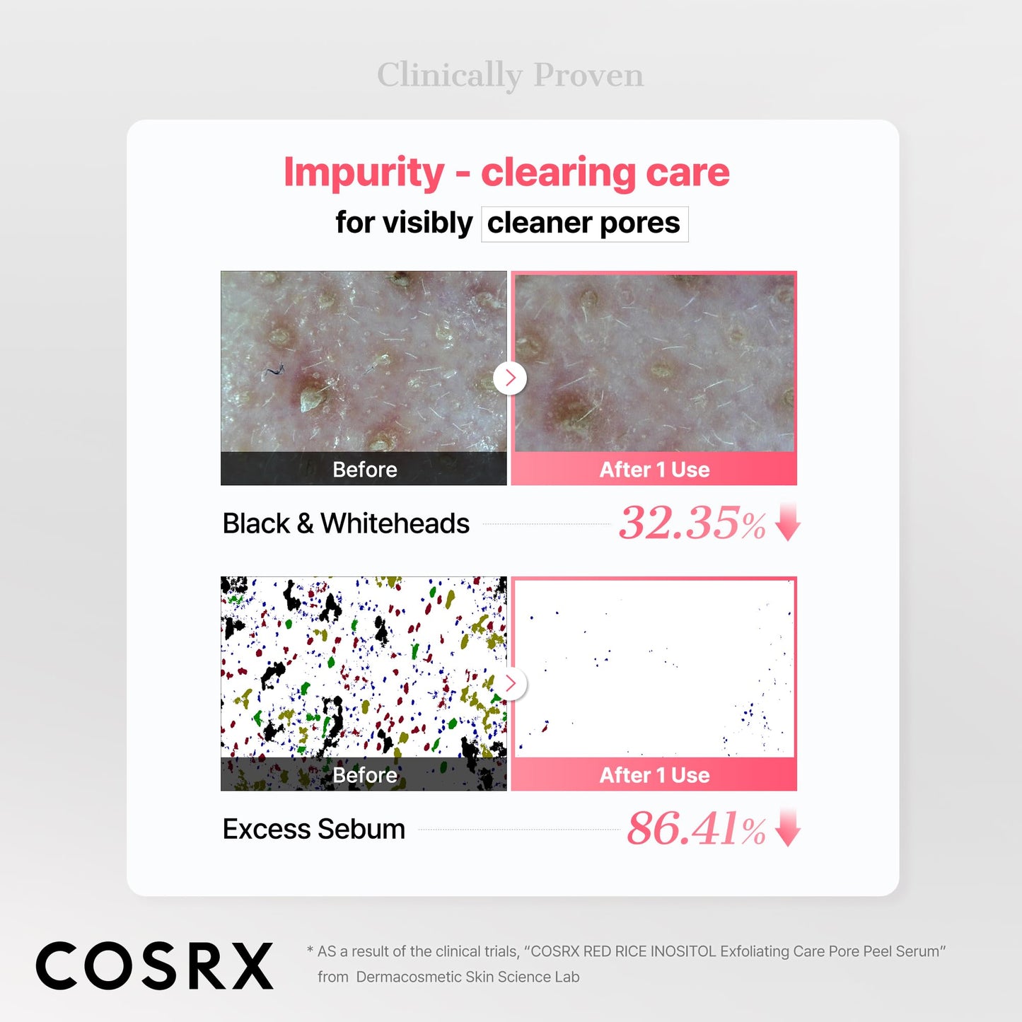 COSRX Red Rice Pore Peel Shot, 94% Reduction in Dead Skin Cells, Gentle Blackhead Remover & Face Exfoliator, Pore Minimizer for Face with Rice Extract & Inositol, AHA BHA PHA, Korean Skin Care