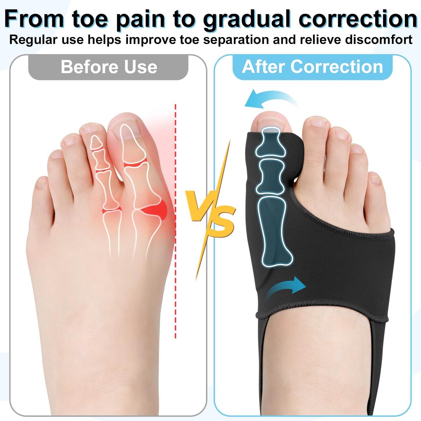 1 Pair Bunion Corrector for Women & Men, Big Toe Straightener for Hallux Valgus Pain Relief & Toe Alignment, Soft and Breathable for Day/Night, Wide Non-slip Strap, Include a Massage Ball (Black)
