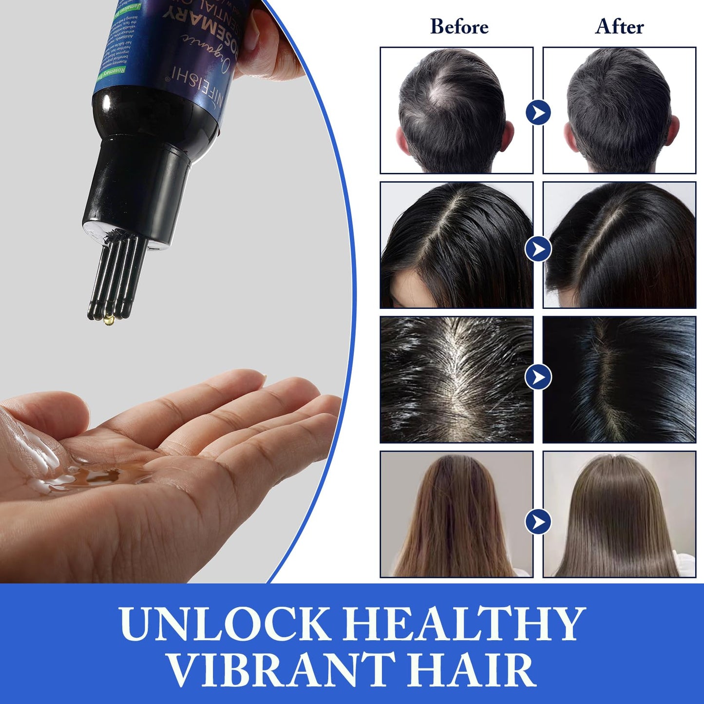 Rosemary Essential Oil for Hair Growth, Scalp Massage and Body - 120ml Pure Organic Infusion with Castor Oil, Improves Blood Circulation, Reduces Hair Loss