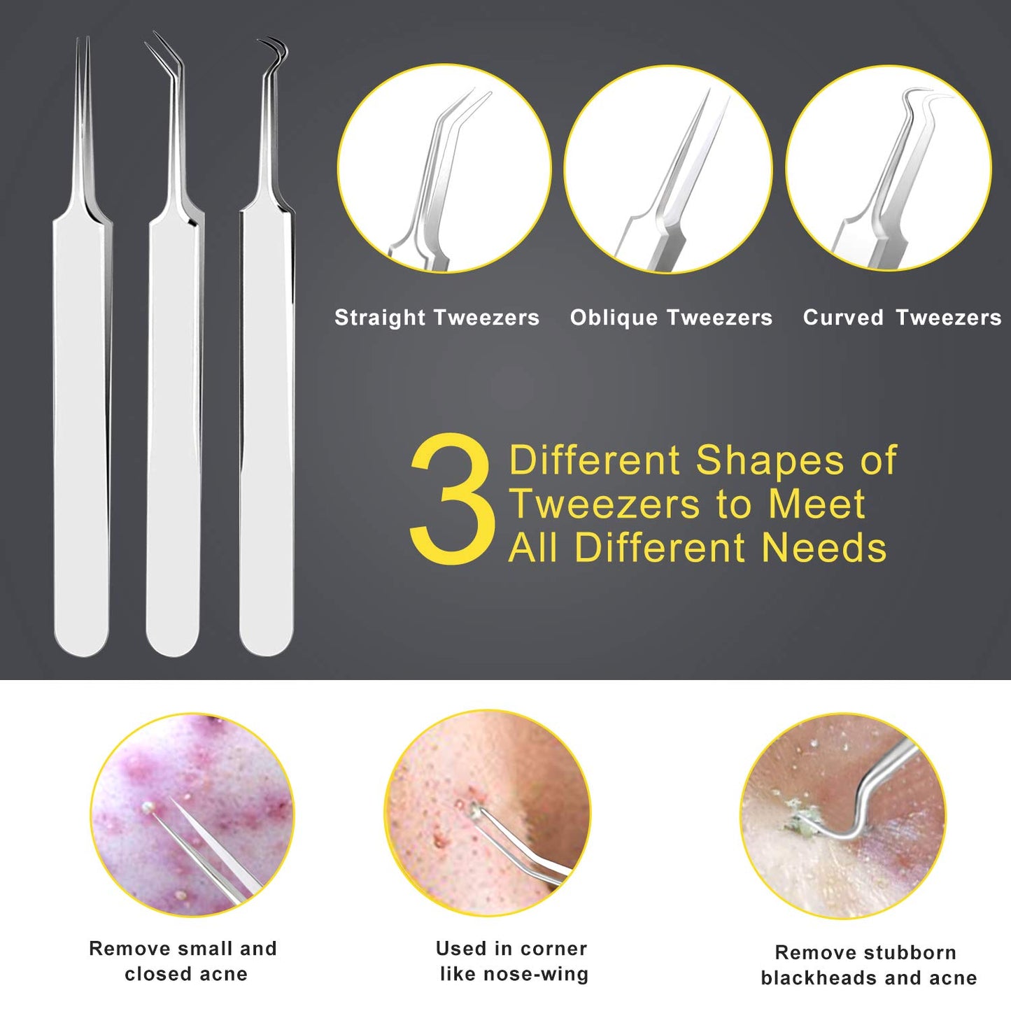 Pimple Popper Tool Kit - Boxoyx 10 Pcs Blackhead Remover Comedone Extractor Kit with Metal Case for Quick and Easy Removal of Pimples, Blackheads, Zit Removing, Forehead,Facial and Nose(Silver)
