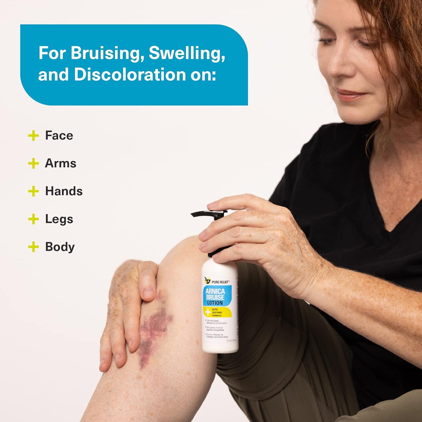 Arnica Cream for Bruise Relief - Extra Strength Moisturizing Formula with Vitamin K & Collagen | 4 Fl Oz