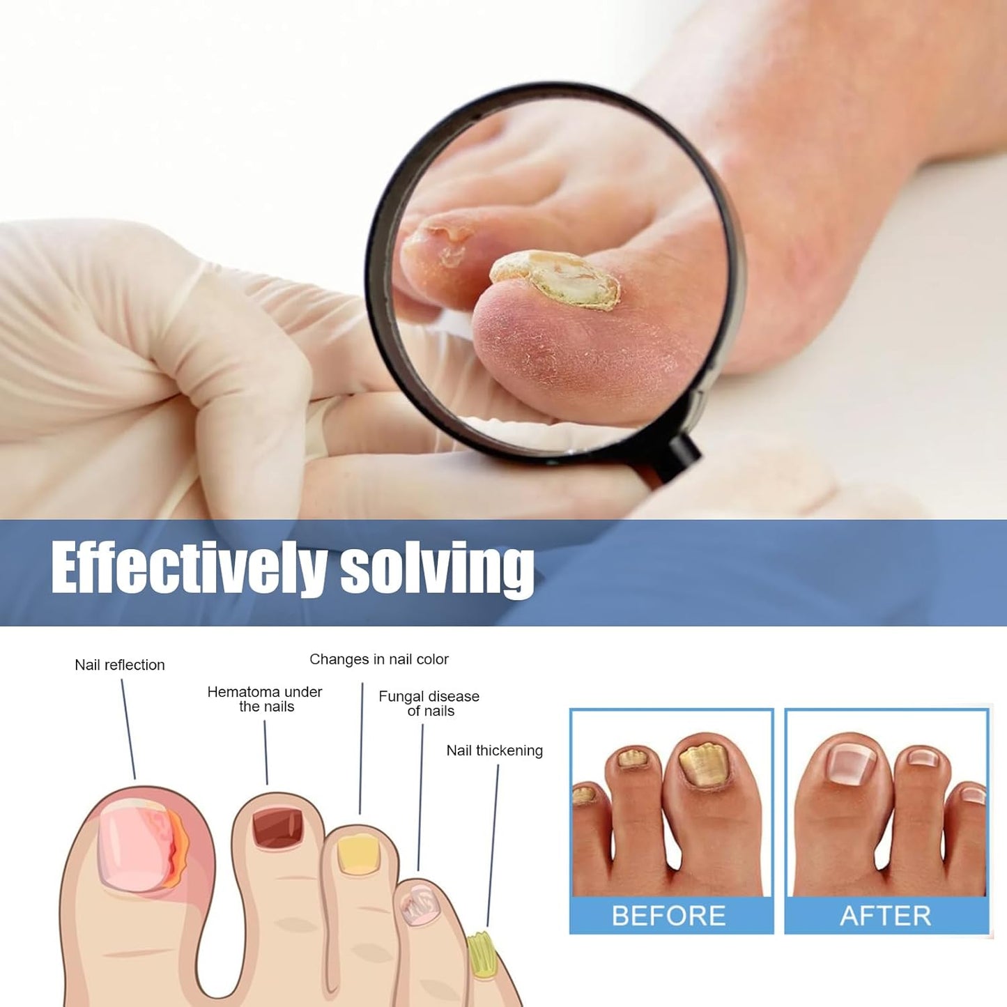 Nail Fungal Repair Patches - Extra Strength Treatment for Healthy Nails | 60 Pcs, 8-Hour Overnight Solution