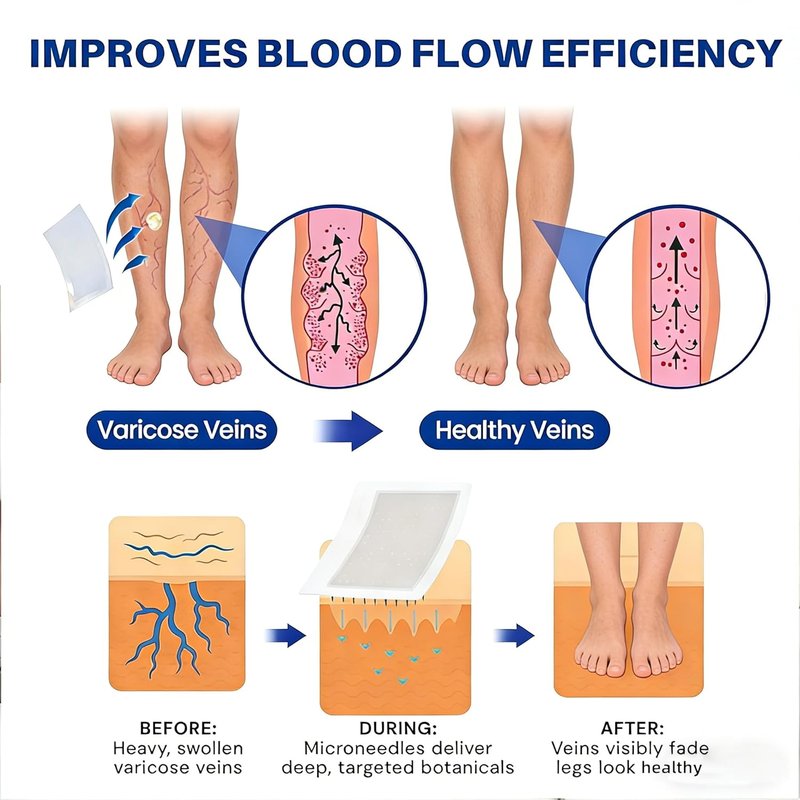 Vein Ease Microdarts Care Patch - Varicose Veins Treatment for Legs | Natural Ingredients, 2 Boxes