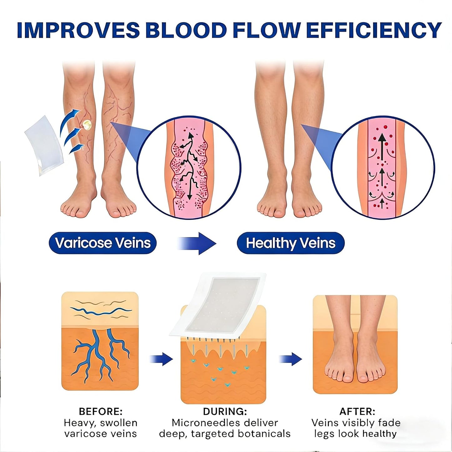 Vein Ease Microdarts Care Patch | Professional Varicose Veins Treatment for Legs - Natural Ingredients, 2 Boxes