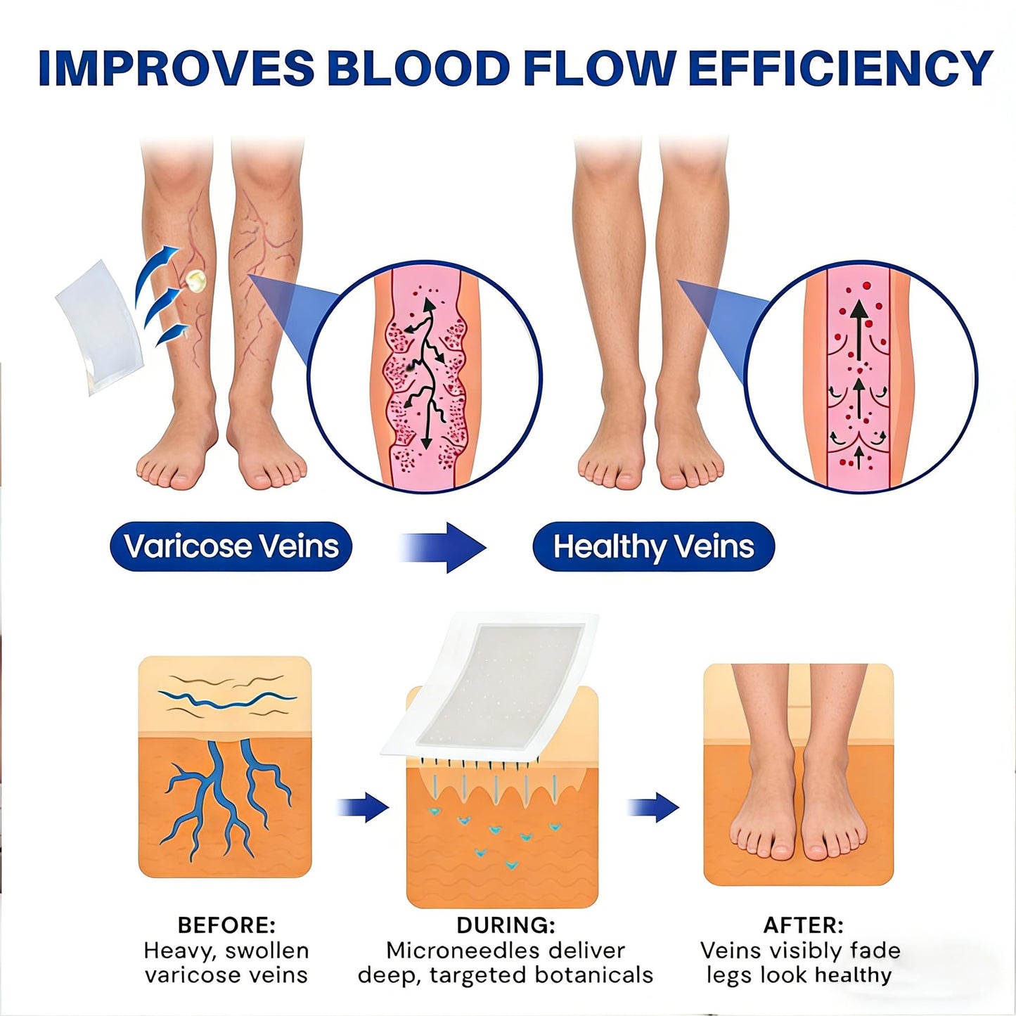 Vein Ease Microdarts Care Patch,Professional Varicose Veins Treatment for Legs Patches, Vein Ease Patch, Ease blood Circulation, Natural Ingredients Leg Treatment for All Skin Types(2 Boxes)