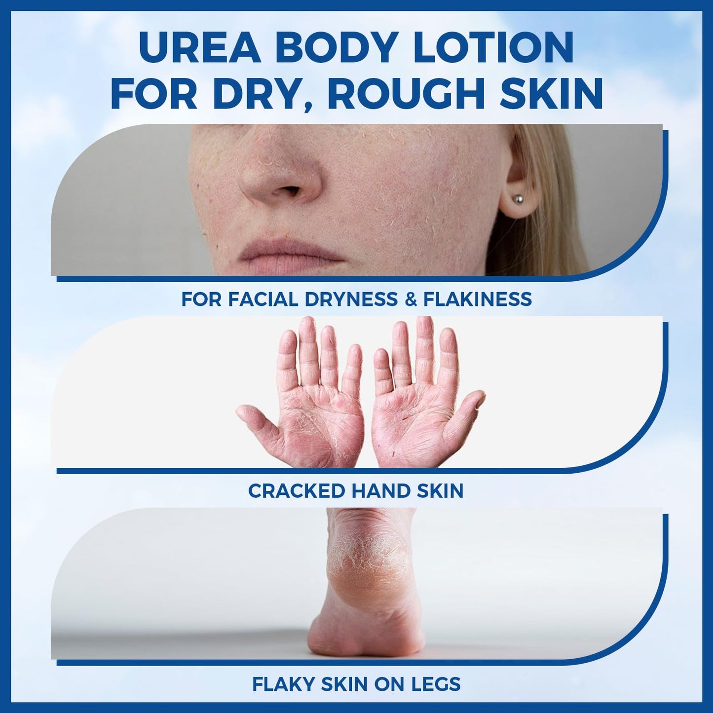 OUKEYA Urea Cream for Dry Chapped Skin with 10% Urea Deep Moisturizer Body Lotion, Softens & Soothes Hands Elbows Feet Hydrates Locks in Moisture, Fast Absorbing & Non-Greasy, 11.28 oz Large Capacity