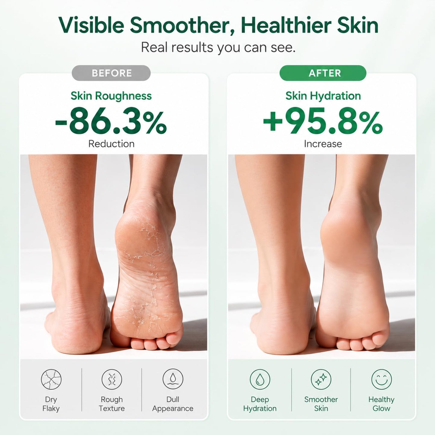 FAMIKYA Urea Cream 40 Percent for Feet Maximum Strength, Foot Cream for Dry Cracked Heels, Callus Remover with 2% Salicylic Acid, Moisturizer for Hands Elbows Knees Rough Skin, 3 Packs