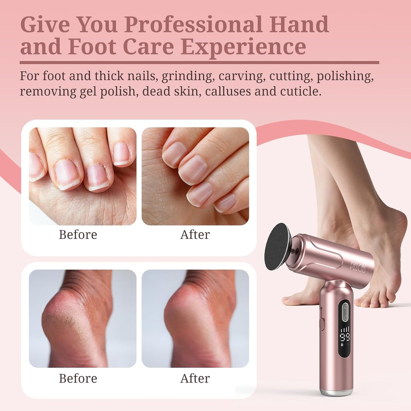 Electric Foot Callus Remover - 2-in-1 Manicure & Pedicure Kit with LED Screen | Cordless Foot File, 100 PCS Sandpapers, Pink