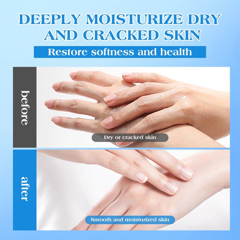 Urea Cream for Dry & Cracked Skin - 42% Moisturizer with Salicylic Acid, Vitamin E & Aloe Vera | Foot & Hand Repair Cream