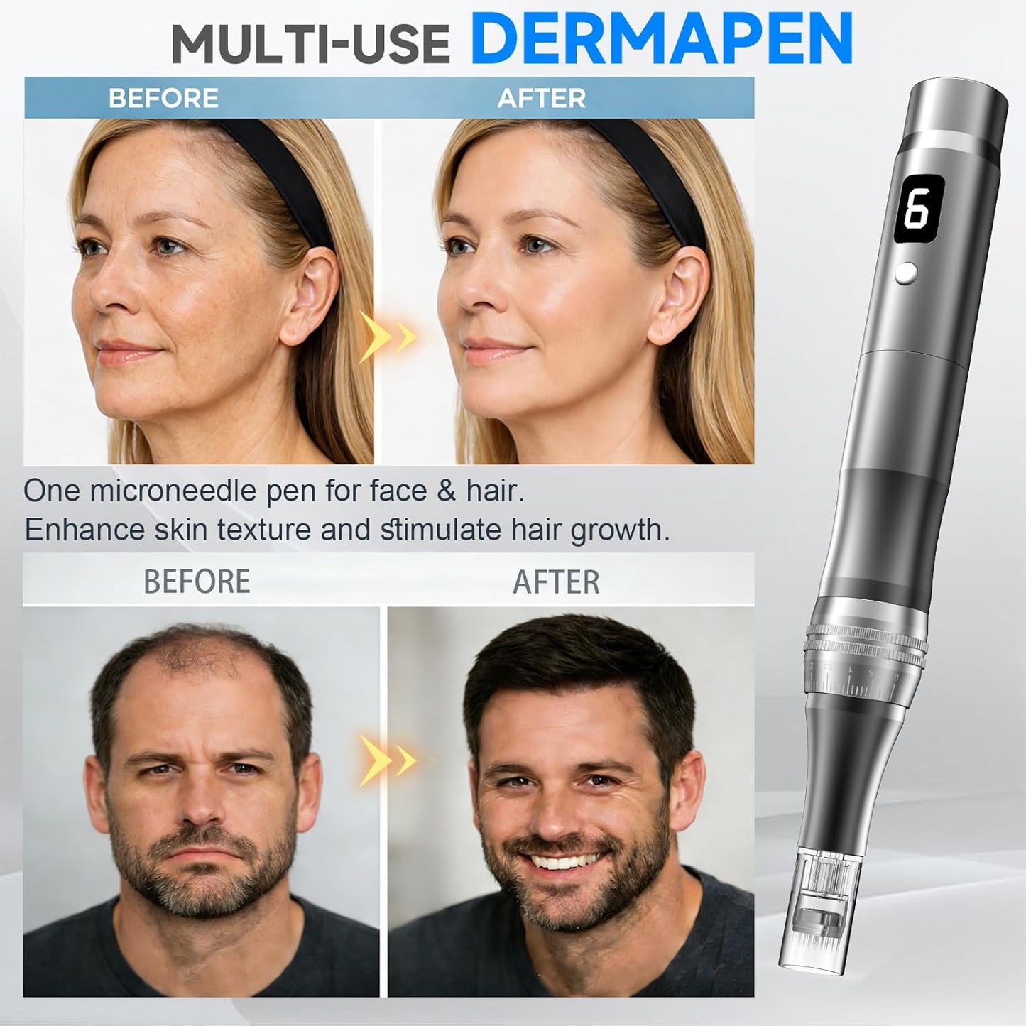 Rechargeable Microneedling Pen - Adjustable Depth Micro Needle for Skin Care | 0.25MM Black