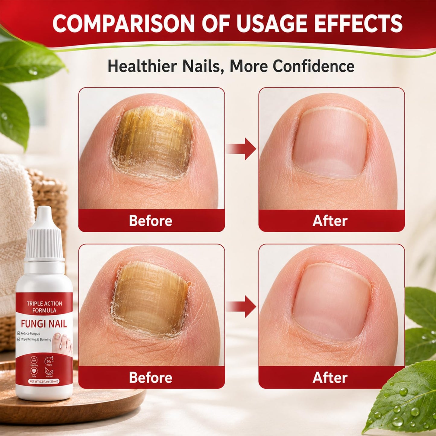 2PCS Toenail Care, Gentle Formula, Effectively Improves Nails for a More Beautiful Appearance for Men and Women