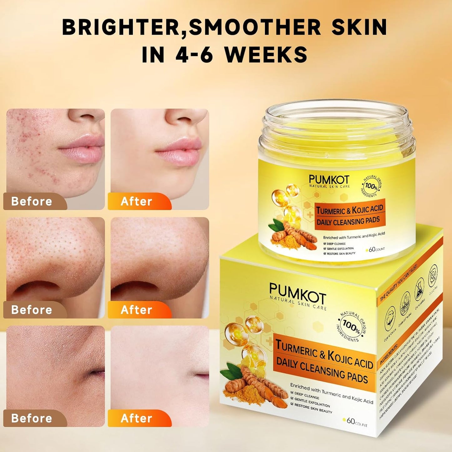 Turmeric Kojic Acid Cleansing Pads - Exfoliating Face Scrub Pads | 60 Count