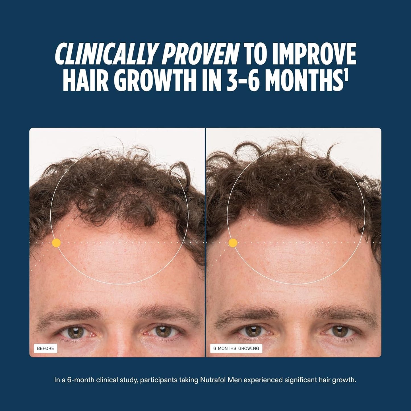 Nutrafol Men's Hair Growth Supplements - Clinically Tested for Thicker Hair | 1 Month Supply, Refill Pouch