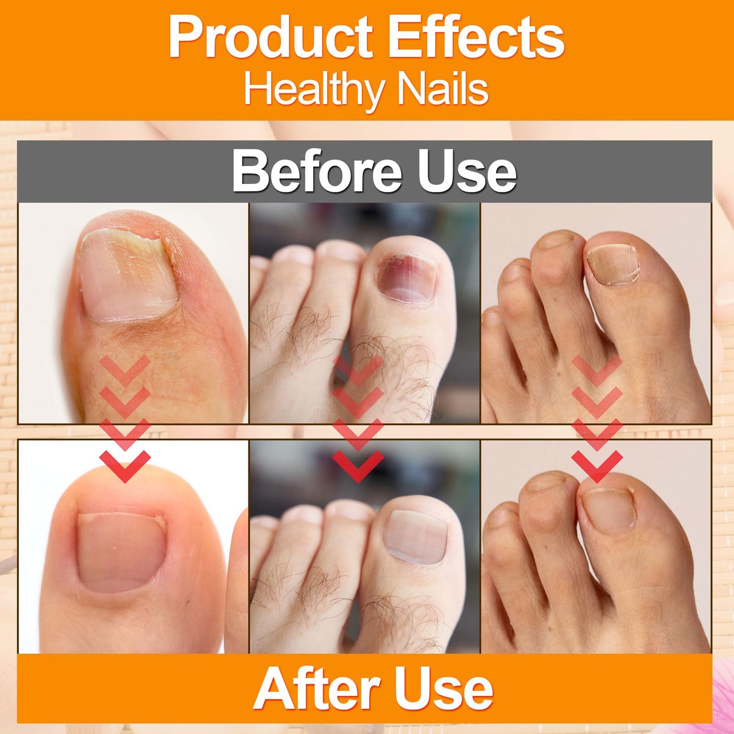 100pcs Nail Patches, 8-Hour Overnight Toenail Appearance Strips Extra Adhesive Daily Nail Nursing Stickers