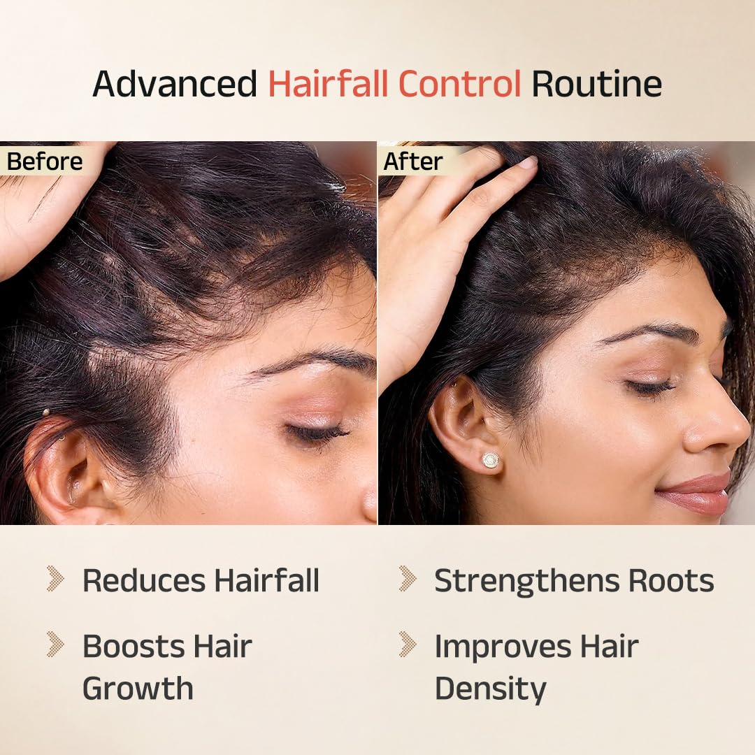 Vedix Keshamrut Hair Care Combo With Keshamrut Herbs Infused Hair Oil, Davath Hairfall Shampoo and Vithan Pro Hair Growth Serum (100 ml + 200 ml +40ml)