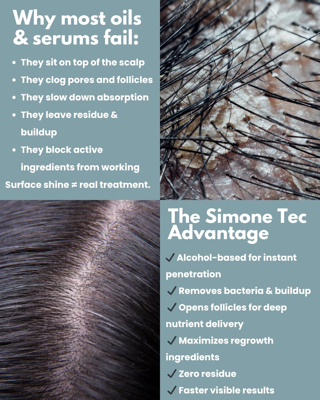 Anti-Hair Loss Shampoo - Simone Tec Scalp Care Strengthening Formula | 10ml Treatment Included