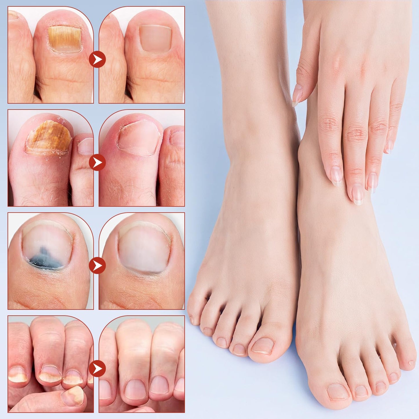 Extra Strength Toenail Treatment - Overnight Nail Patches for Damaged Nails | 42 Pcs