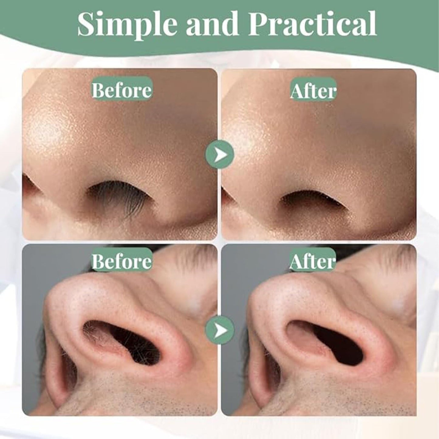 Calefow 12Pcs Nose Hair Trimmer，2-in-1 Nasal Hair Cutter，Upgraded Manual 360° Rotating Nostril Hair Removal Tool Double Sided Nose Hair Blade for Women Men Personal Cleaning